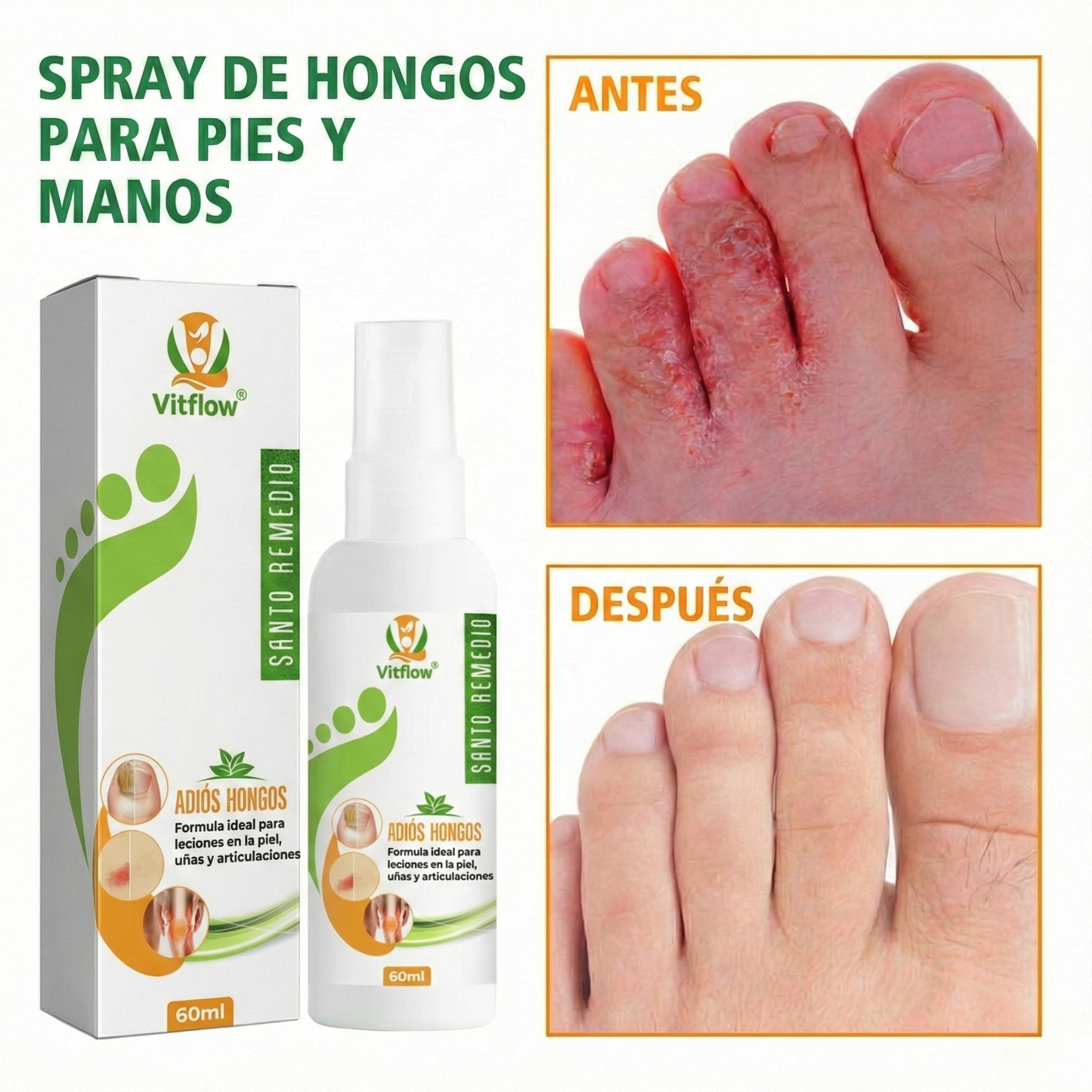 DermoGuard™ | ¡Adiós Hongos y Mal Olor!