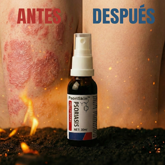 PsoriSkin™ | ¡Adiós Psoriasis Para Siempre!