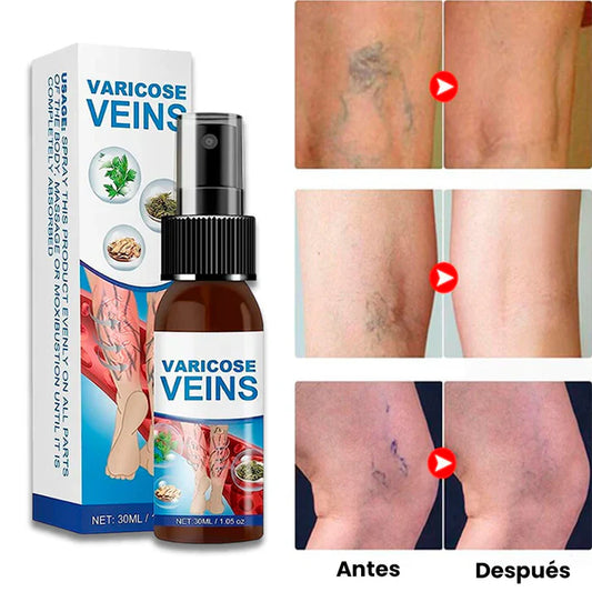 SPRAY VARICOSE VEINS™ | REDUCE VARICES Y ARAÑITAS + PIEL SUAVE Y TONO UNIFORME